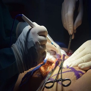 endocrine surgeon in berwick